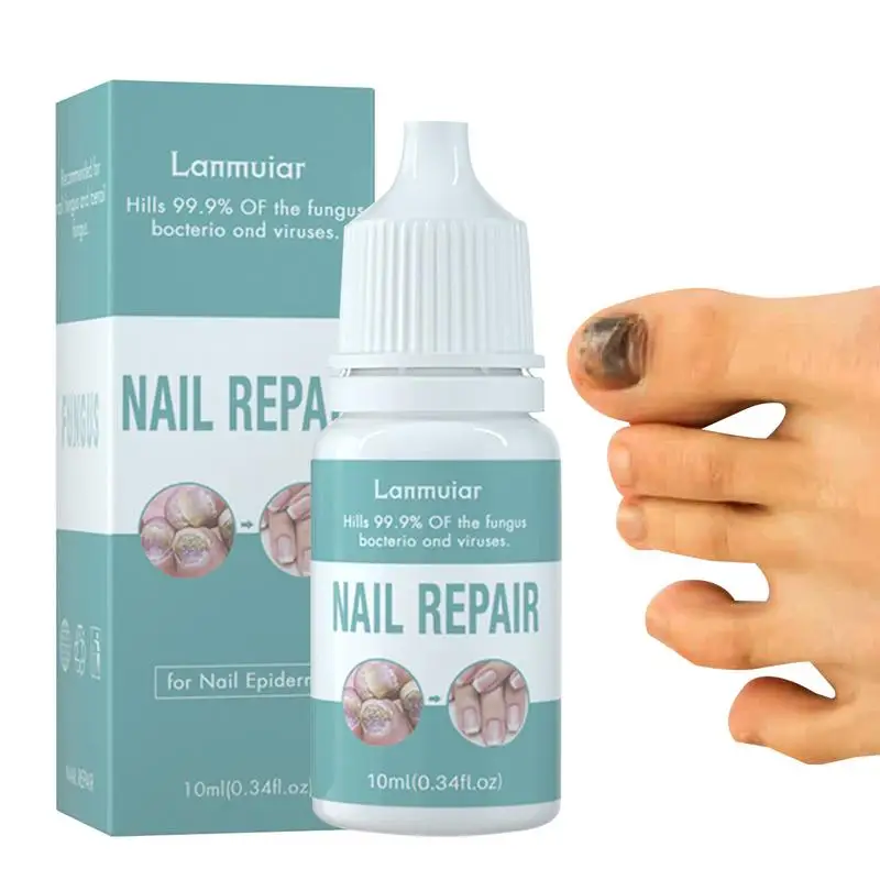 Набор для восстановления ногтей 10 мл Масло для укрепления ногтей для домашнего ухода за ногтями Многофункциональная система обновления ногтей Профессиональный ногти